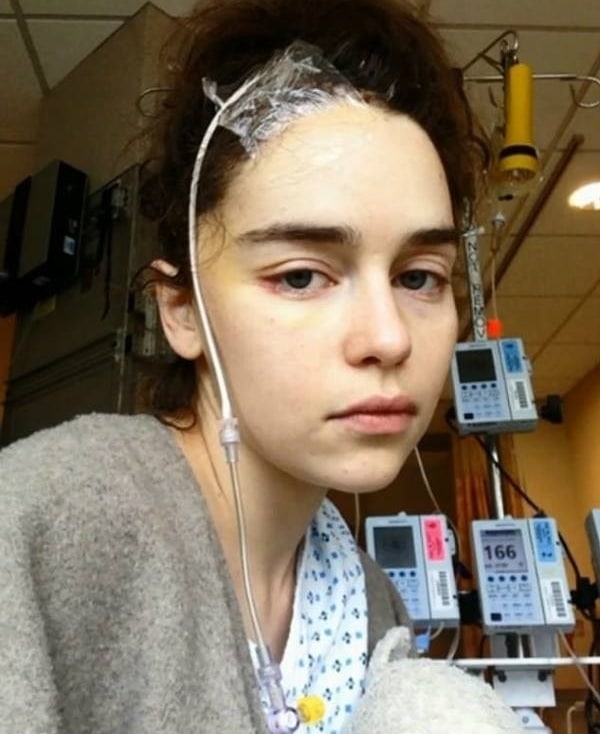 Emilia Clarke em Game of Thrones, a atriz quase morreu por cause de dois aneurismas. (Foto: Reprodução, Instagram)