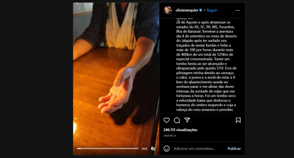Olivier Anquier, famoso do SBT, mostrando sua recuperação pelas redes sociais após acidente (Foto Reprodução/Instagram)